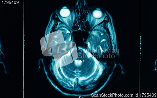 Image of sharp ct scan of the human brain