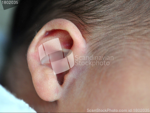 Image of Newborn's Ear