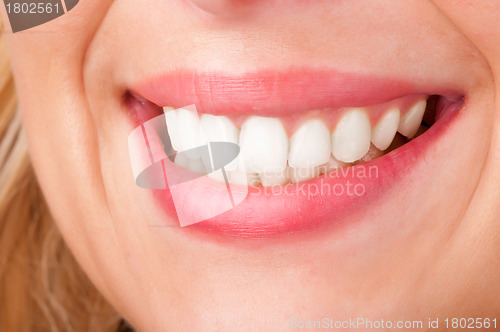 Image of Womans Lips Smiling