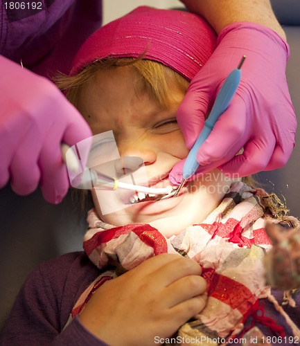 Image of Child in pain at dentist