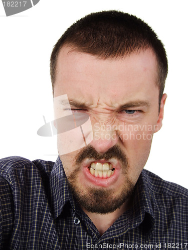Image of Excessively angry facial expression