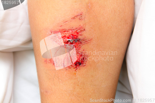 Image of wound