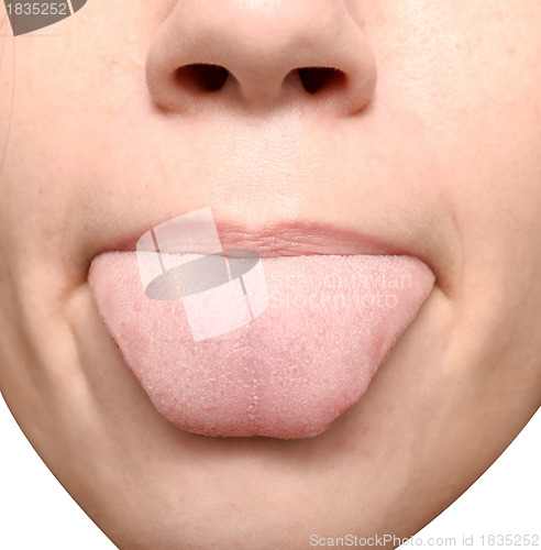 Image of tongue