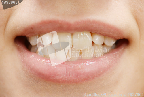 Image of teeth