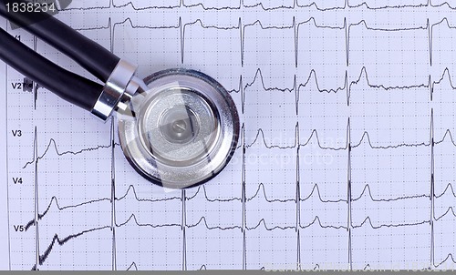 Image of stethoscope and ecg