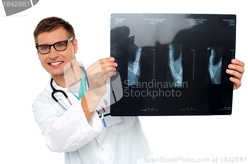 Image of Young specialist peeping from behind x-ray report
