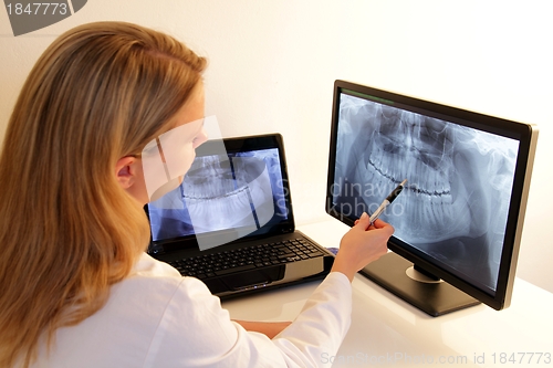 Image of Dentistry explains a dental X-Ray 