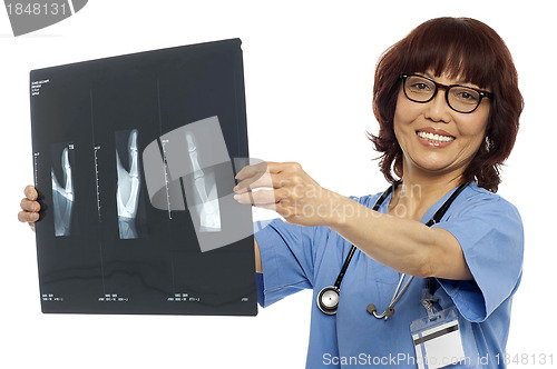 Image of Doctor holding x-ray report. Analyzing it