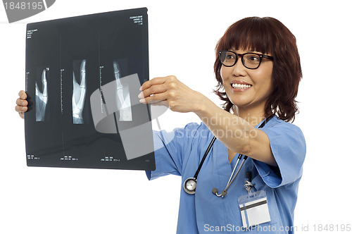 Image of Female doctor reviewing x-ray report