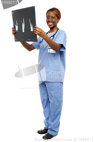 Image of Young medical expert reviewing x-ray report