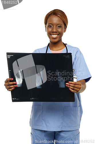 Image of Medical expert holding patients x-ray report