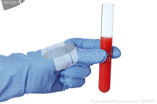 Image of sample of blood