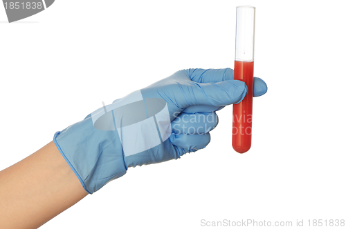 Image of blood test