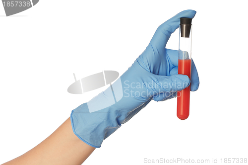 Image of blood test
