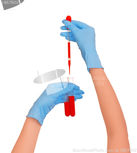 Image of blood test