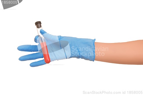 Image of blood test