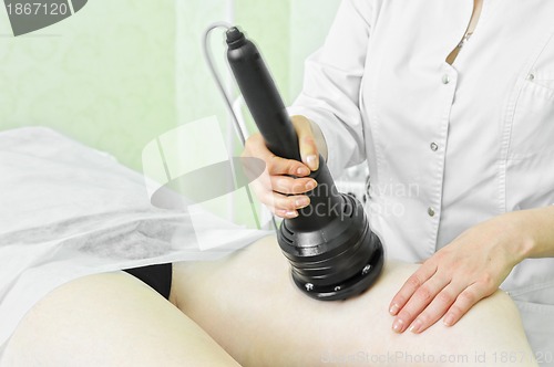 Image of procedure