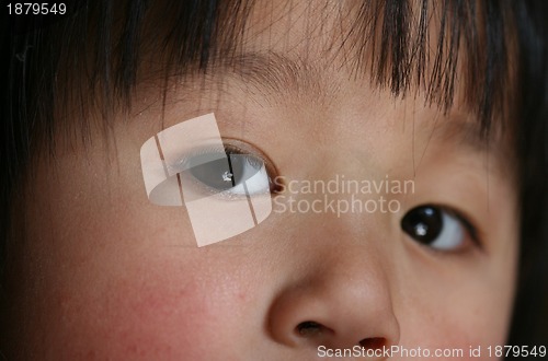Image of eyes