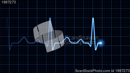 Image of Electrocardiogram