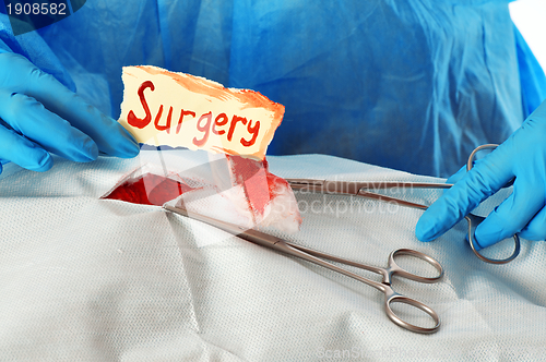 Image of operation with problem