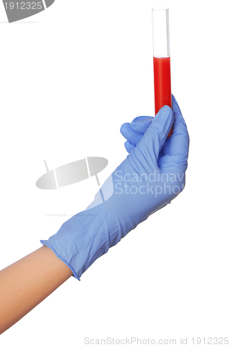 Image of sample of bloods
