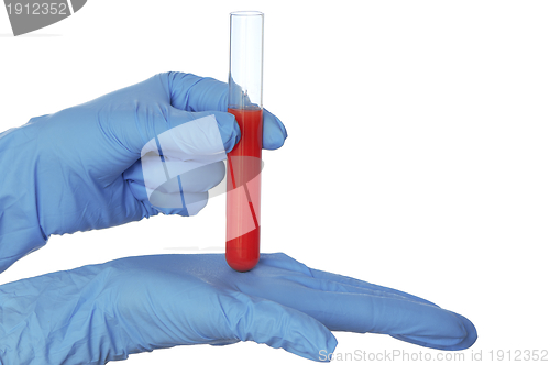 Image of sample of bloods