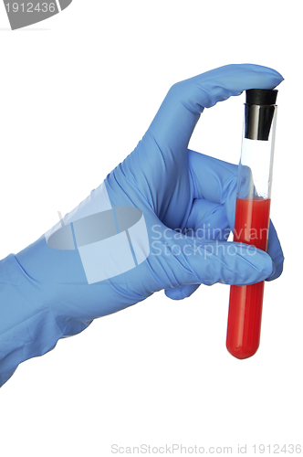 Image of sample of bloods