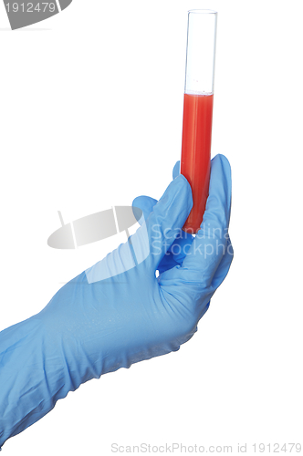 Image of sample of bloods
