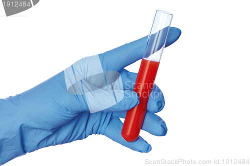 Image of sample of bloods