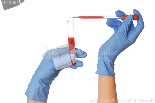 Image of sample of bloods