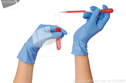 Image of sample of blood