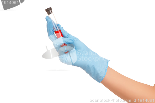 Image of blood test