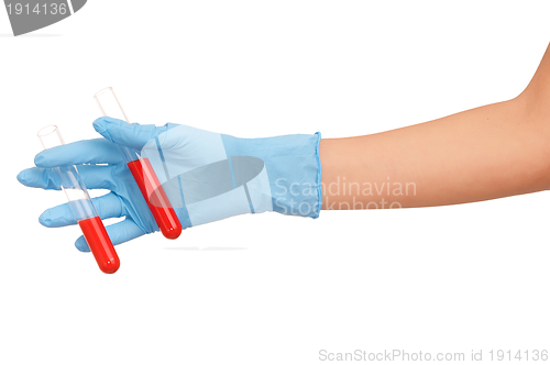 Image of blood test