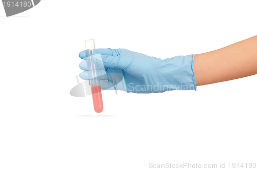 Image of blood test