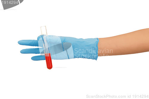 Image of blood test