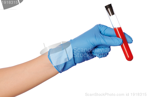 Image of sample of bloods