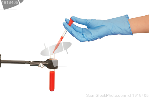 Image of blood test