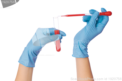 Image of blood test