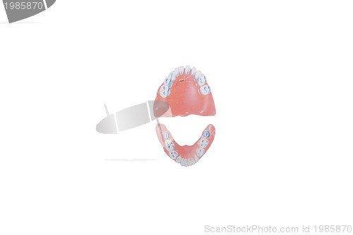 Image of teeth illustration