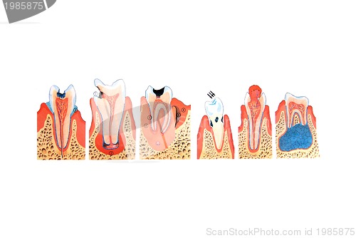 Image of teeth illustration