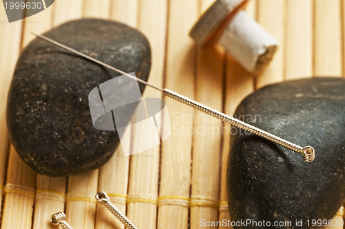 Image of acupuncture needle