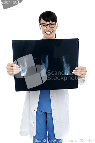 Image of Doctor displaying x-ray report of thumb finger