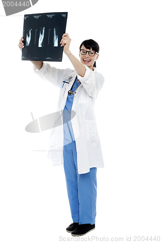 Image of Nurse holding x-ray sheet against light to examine