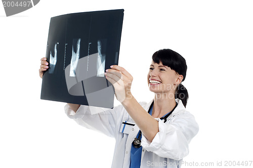 Image of Cheerful female doctor reviewing patients x-ray report