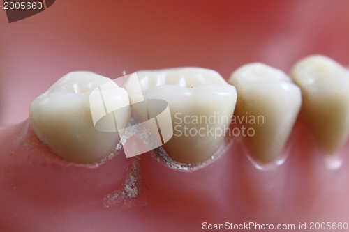 Image of teeth problem 
