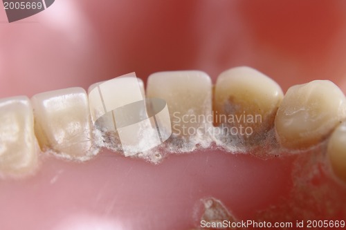 Image of teeth problem 