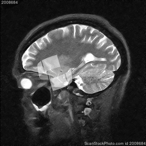 Image of Magnetic resonance image of the human body. Head MRI or CT image