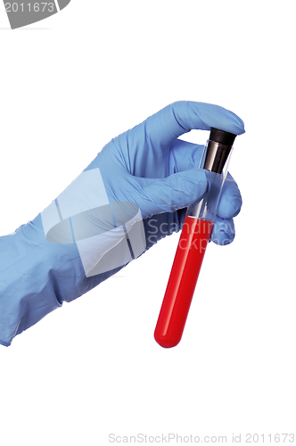 Image of sample of bloods