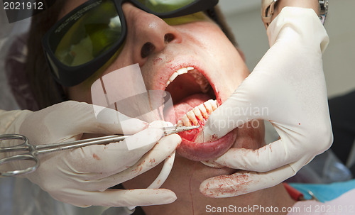 Image of Visit to the dentist. Dentist at work in dental room