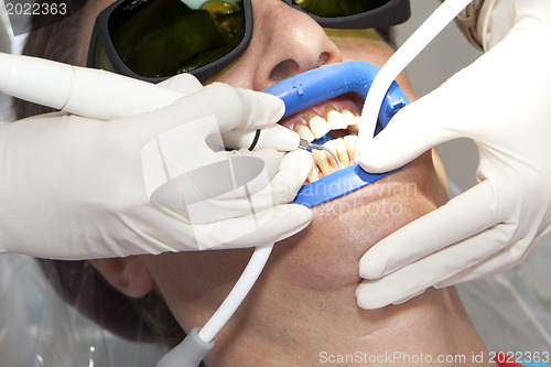 Image of Visit to the dentist. Dentist at work in dental room